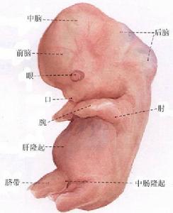 自然流产(女性生育性疾病)