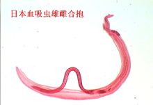 日本血吸虫(寄生虫类)