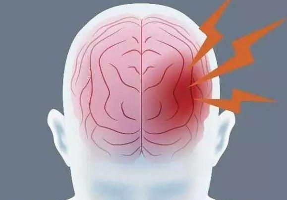 突发性脑溢血(医学名称)