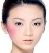晒伤(日照性皮炎)