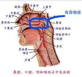 咽喉异物感(咽部的异常感觉)