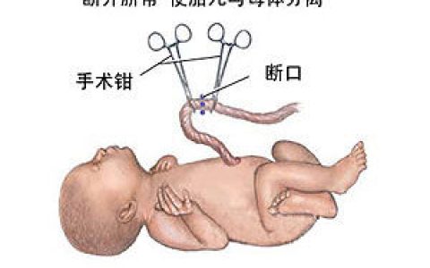 脐带护理(哺乳类的连接胎儿和胎盘的管状结构)