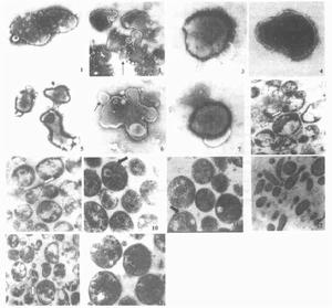支原体(可用人工培养基培养增殖的原核细胞型微生物)