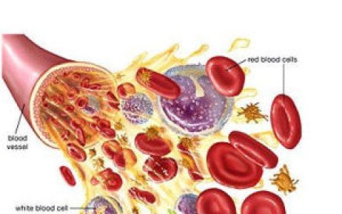 伊文氏综合征(医学领域术语)