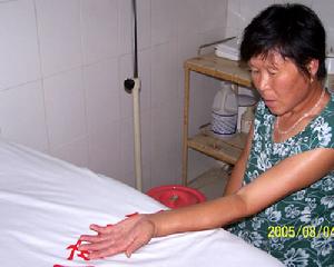 脉管炎(动脉和静脉阻塞不通引起的临床症状)