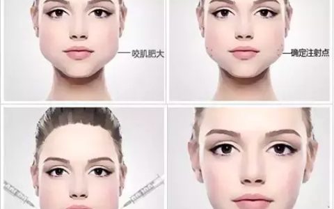 botox瘦脸针(美容材料)