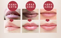 唇纹(嘴唇干燥形成的纹路)