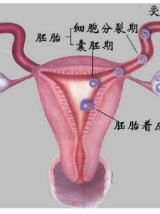 输卵管通水(检查输卵管是否通畅的常用检查方法)