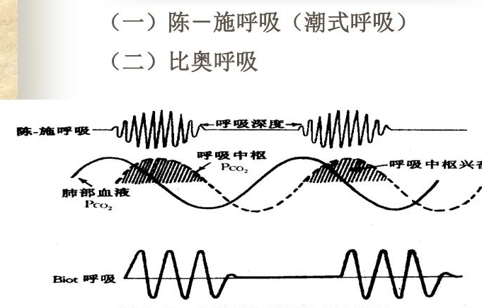 比奥呼吸(病理性的周期性呼吸)