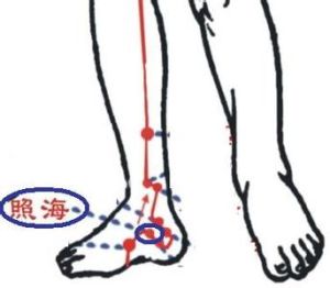 照海穴(穴位名称)