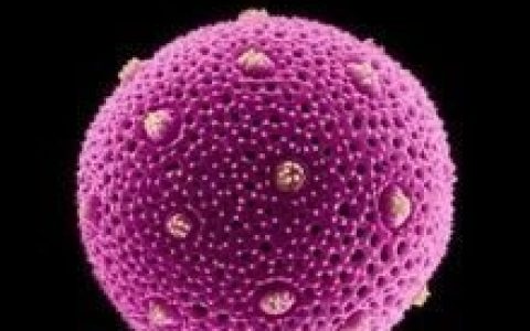 过敏体质(医学专业词汇)