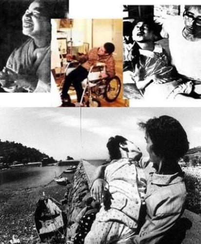 日本水俣病事件(1956年于日本发生)