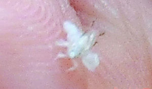榆四脉绵蚜(四脉绵蚜属害虫)