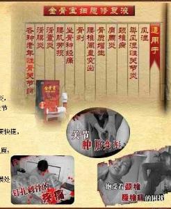 金骨宝(安徽众康药业有限公司生产的保健品)