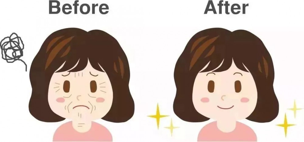 初老症(病症)