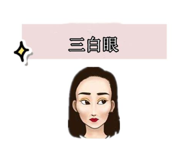 三白眼(瞳仁很靠上或者很靠下看上去三面的眼白很多)