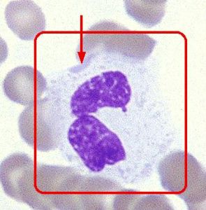 包涵体(生物大分子结构)