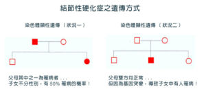 结节性硬化症(是一种常染色体显性遗传的神经皮肤综合征)