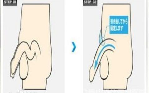 阴茎短小(医学术语)