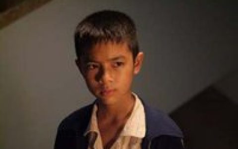 扁头综合症(婴儿头骨发生不同程度的扁平畸形)