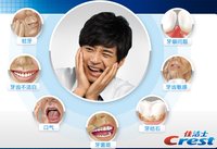口腔疾病(发生在口腔的疾病)