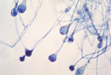 毛霉(接合菌亚门接合菌纲毛霉目毛霉科毛霉属真菌)