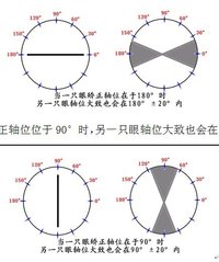 散光轴位(眼睛的不正常状况)