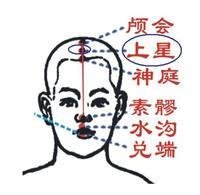 神庭穴(人体经脉穴位)