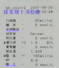 尿常规化验单(尿常规检查所得结果)