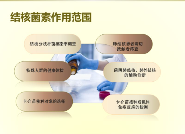 结核菌素试验(结核菌素试验又称PPD试验)