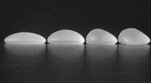 硅胶隆胸(将硅凝胶假体植入胸部的一种手术)