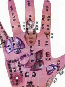 手心热(疾病病症)