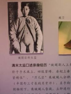 净身(宫刑)