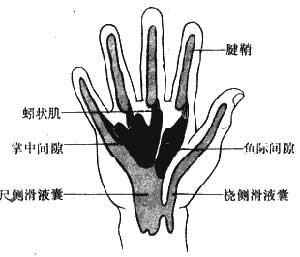 大拇指腱鞘炎解剖图片图片