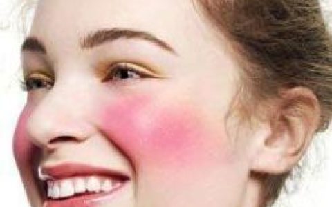 毛细血管破裂(疾病症状)