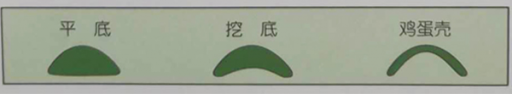 单凸平底型+面凸底凹型