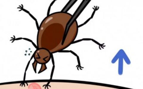 如何彻底杀死蜱虫,杀死蜱虫最彻底的方法
