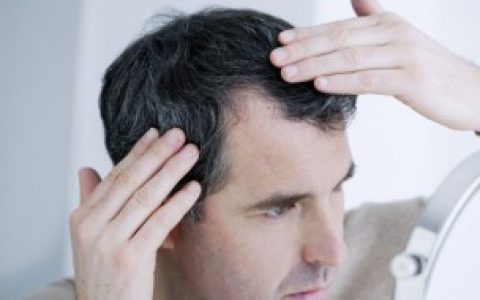为什么冬天头皮屑特别多（冬天头皮屑特别多原因）