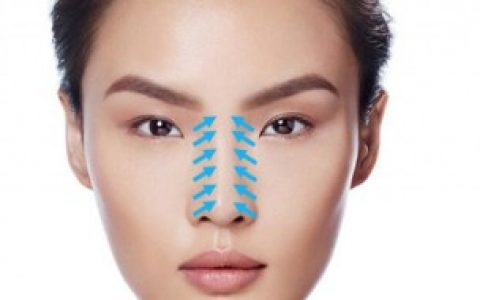 【额头川字纹如何消除】额头川字纹怎么消除