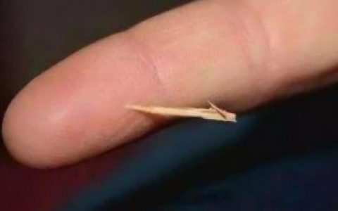 手里有刺取不出来如何办,手里有刺取不出来怎么办