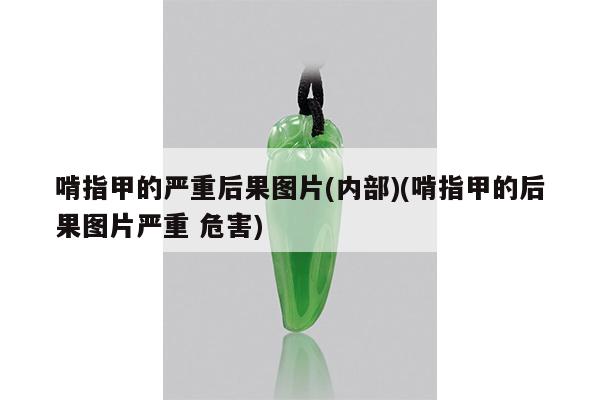 啃指甲的严重后果图片(内部)(啃指甲的后果图片严重 危害)